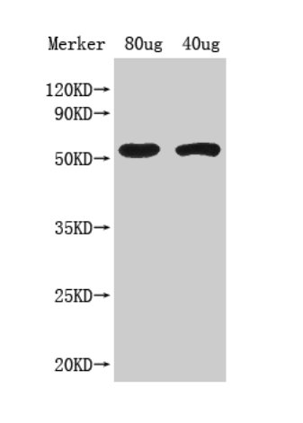 Western blot using anti-ACS8 antibodies